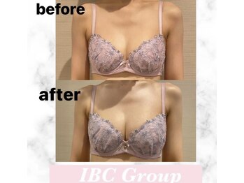 IBC 横浜馬車道店/バストアップ症例C→E!