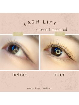 ナチュラル ビューティー ベルポート(natural beauty Bellport)/ラッシュリフトビフォーアフター