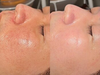 ルーナジェーナ(Luna llena)/