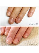 リネイル 長浜(Re-na-iL)/ネイルケア＆スパ¥7000