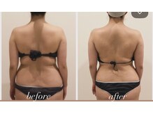 TMサロン 赤坂の雰囲気（もっこり肩はインナーマッスル、腸や内臓のバランスを整えます）