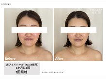 サンイチイチ(311)/大人気！平日限定クーポン♪