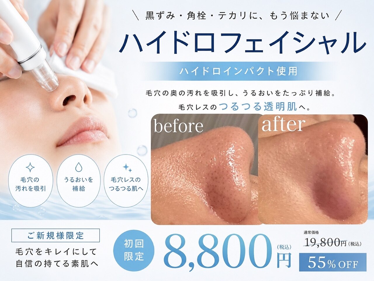 有名エステのパルティール(partir)のSURELINE a です パルティール(PARTIR)｜ホットペッパービューティー