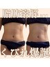 【脂肪分解3cc】浮き輪肉を落としてくびれを作りたい方 通常¥26,300