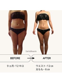 サンテボーテ(Sante Beaute)/集中ダイエット