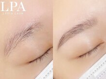 レピア 仙台店/韓国式LEPIA Before&Aｆter