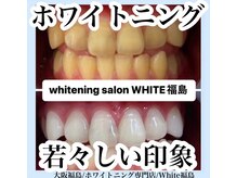 ホワイトニングサロン ホワイト(WHITE)/セルフホワイトニング/大阪/福島
