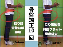 北てんま整骨鍼灸院/姿勢改善で腰痛解消！！
