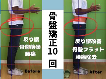 北てんま整骨鍼灸院/姿勢改善で腰痛解消!!
