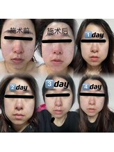 ユミサロン(U Mi Salon)/「Before→Afterの実感。