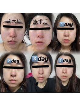 ユミサロン(U Mi Salon)/「Before→Afterの実感。