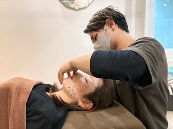 アラキ(ARAKI)/緑橋で美容鍼してみませんか。