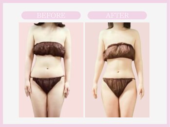 スリムライン 山形店(The Slim Line)/before→after