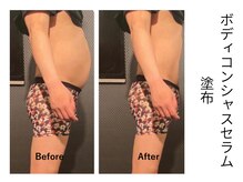 リルマコ/ボディ症例写真