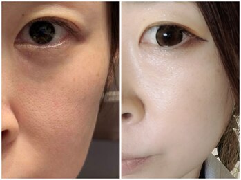 トリニティスペース(TrinitySpace)/美白カクテル×プラズマ