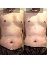 アリッチ 岡崎店(a.Rich)/