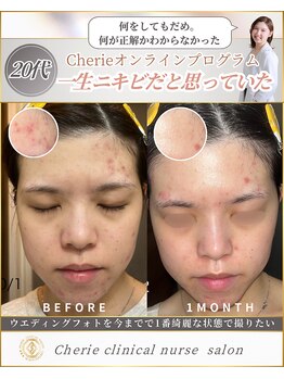 シェリー(Cherie)/結婚式に一番綺麗な自分でいたい