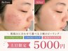 【北千住店 土日限定!!】肌悩み別にご提案◎3種ピーリングから選択可