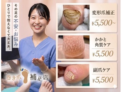 仙台巻き爪補正店の写真
