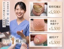 仙台巻き爪補正店