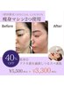 春の肌荒れニキビ・毛穴ケア殺菌&凹凸解消+美容液導入パック付☆30分￥5,500→