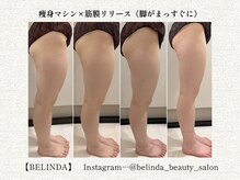 ベリンダ 中崎町店(BELINDA)の雰囲気（マシンケアや筋膜リリースでお悩みに合わせてアプローチ☆）