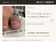 サロン ケー(Salon K)/巻き爪ケア　お客様の声3