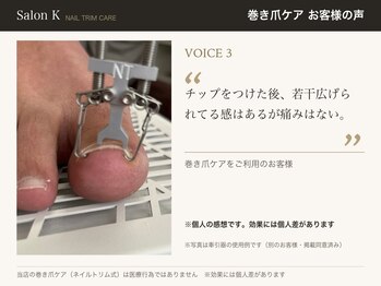 サロン ケー(Salon K)/巻き爪ケア　お客様の声3