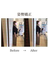 心斎橋長堀フェムテック整骨院/18姿勢矯正　骨格矯正と骨盤矯正