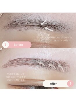 シャルトルズ/症例写真5