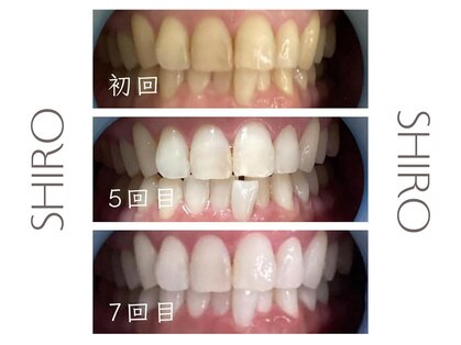 シロ 朝霞台店(SHIRO)の写真