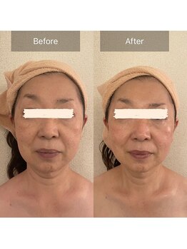 エメ(Aimer)/【60代結果写真☆】