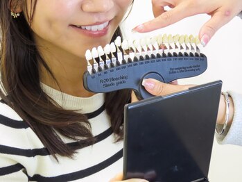 エクシアホワイトニング 徳島店/トーンチェック風景