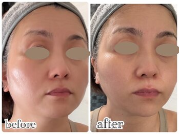 ニュイ(nuit)/ララピール+OMEGA PDT