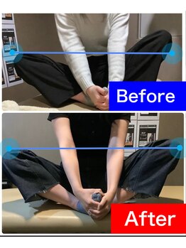 ナオル整体 岐阜院(NAORU整体)/20代女性　「骨盤の歪み」