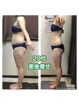美ボディラボ(美Body Labo)/20代産後痩せ