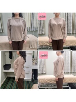 こじ 金沢院/猫背&反り腰撃退☆