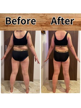 あきくに整骨院 美容整体院/N様ビフォーアフター