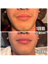 シンバ 倉敷店(SIMBA)/