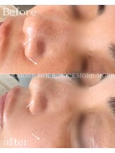 モア 吉祥寺(MORE.)/BeforeAfter