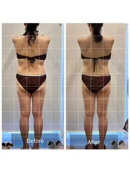 プリューム(PLUME)/本気痩せリンパマッサージ150分