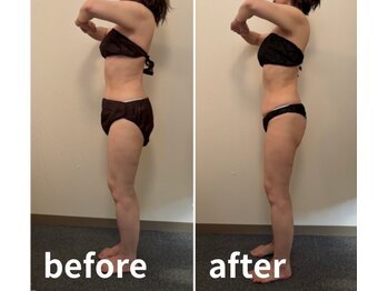 ドクターエイジレス(DR.AGELESS)/きつい万年ダイエットさよなら!