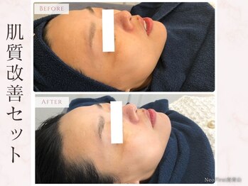 ネオファースト(NeoFirst)の写真/【外苑前駅★徒歩3分】完全都度払いの新しいカタチのエステサロン♪結果重視のトータルビューティーサロン!