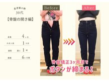 ココア 春日井店(cocoa)/整体&産後骨盤矯正&痩身/春日井