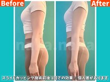 ナカナカ 東中野(naka.naka)の雰囲気（スライドカッピングの施術で身体の変化を是非体験してみて下さい）
