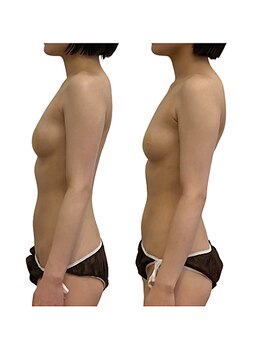 ベンザイ 新潟店(BENZAI)/疲れると猫背になる人