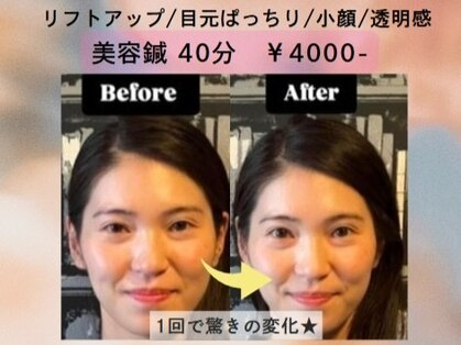 松山鍼灸マッサージ院の写真