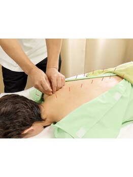 首・肩のつらさを改善したい