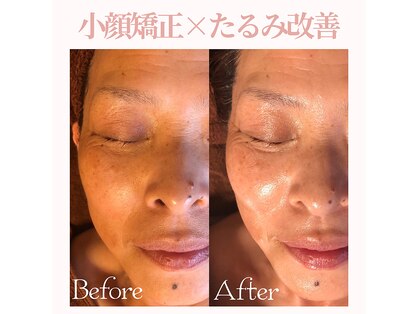 エステサロン マコ(MaCo)の写真