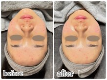 ニュイ(nuit)/ララピール4回目